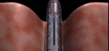 8641597121281503.jpg 微信圖片_20200811124745.jpg